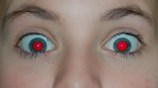 red eye removal